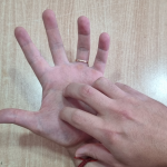 qué significa cuando te pica la mano izquierda