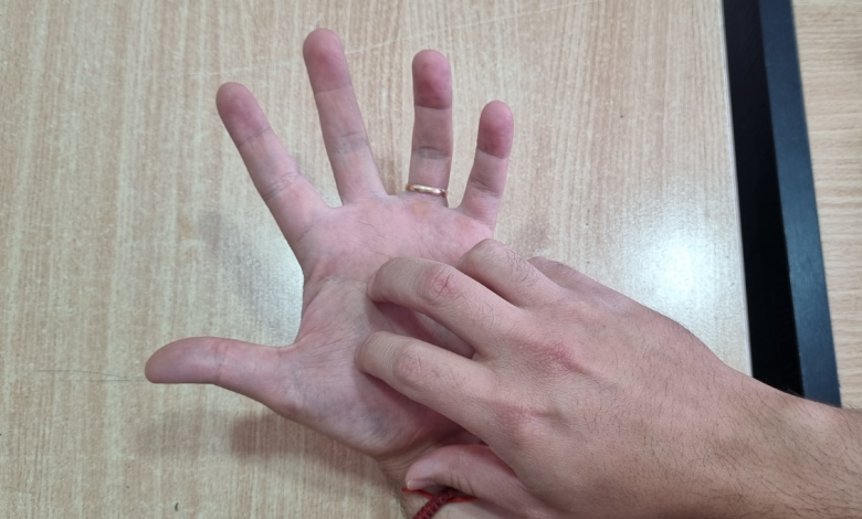 qué significa cuando te pica la mano izquierda