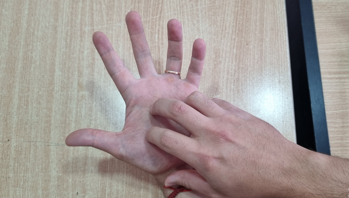 qué significa cuando te pica la mano izquierda