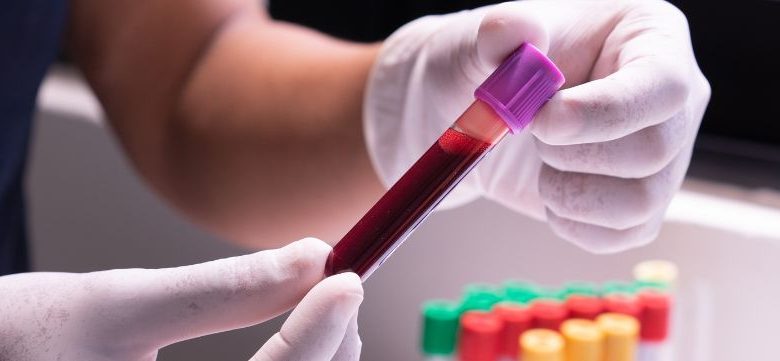 qué significa hematología