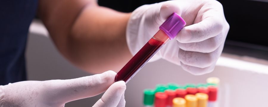 qué significa hematología