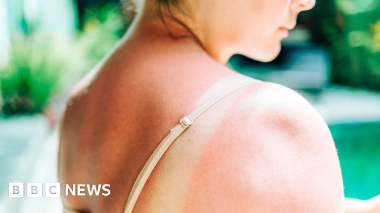 El cáncer de piel más agresivo bate récords en Reino Unido